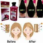 Wellice Professional Onion Anti Hair Loss Shampoo 400g- NS Suppliers